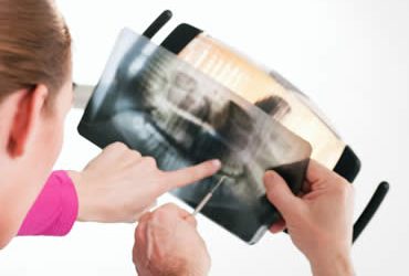 How to Prepare Your Child for Wisdom Teeth Extraction