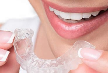 Can Choosing Invisalign Really Keep My Mouth Healthier?