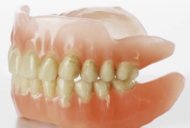 Dental Implants: An Alternative to Dentures and Bridges